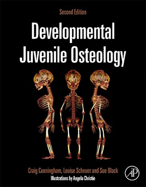  Developmental Juvenile Osteology 