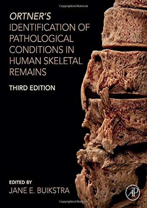  ORTNER´S IDENTIFICATION OF PATHOLOGICAL CONDITIONS HUMAN SKELETAL REIMAINS 