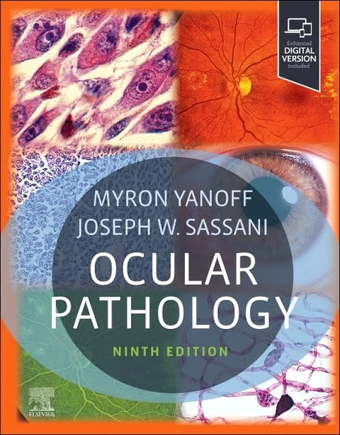  Ocular pathology 