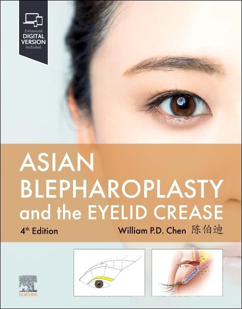 ASIAN BLEPHAROPLASTY AND THE EYELID CREASE