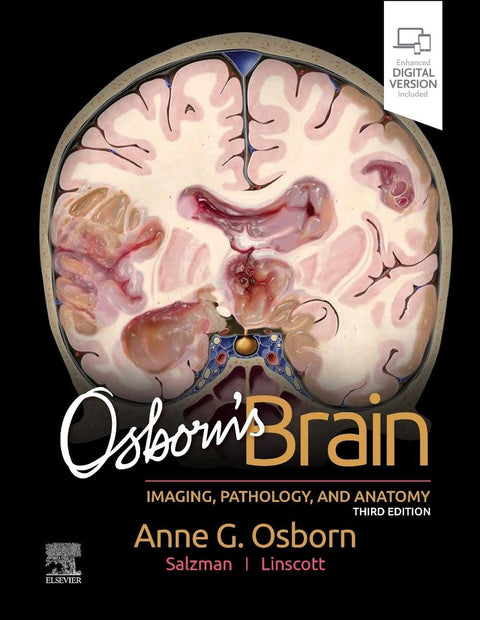  OSBORN'S BRAIN 3RD.EDITION 