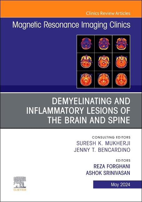 DEMYELINATING INFLAMMATORY LESIONS BRAIN SPINE VOL.32-2 