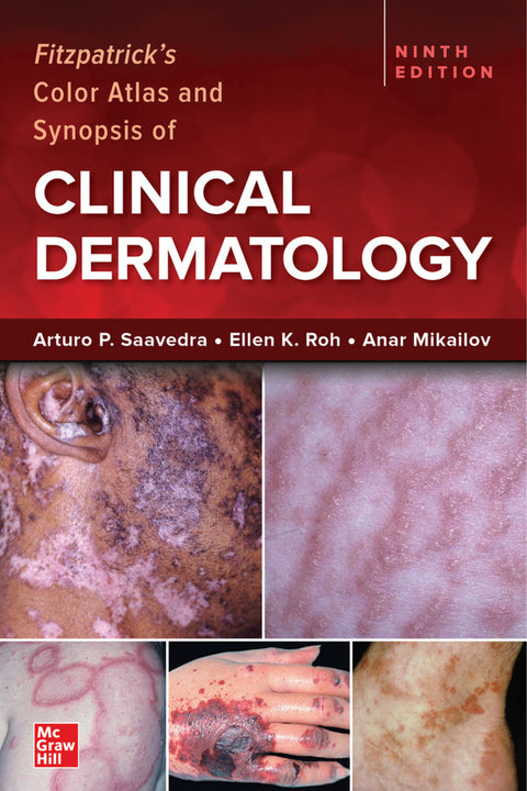  Fitzpatrick's Color Atlas and Synopsis of Clinical Dermatology, Ninth Edition 