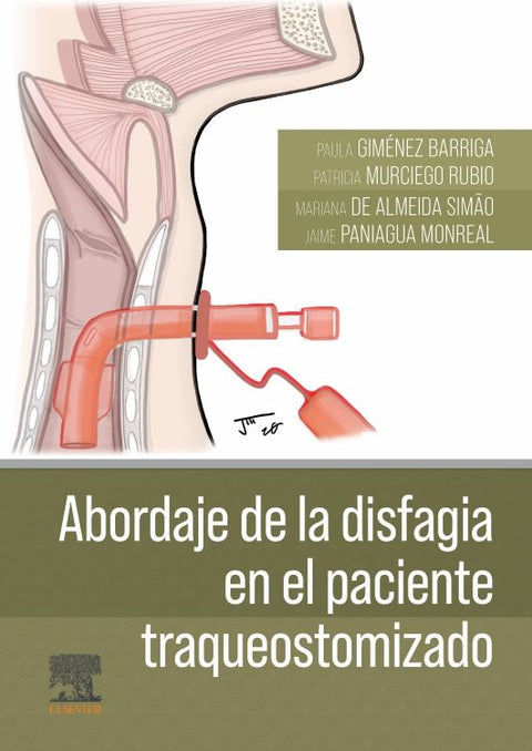  ABORDAJE DE LA DISFAGIA EN EL PACIENTE TRAQUEOSTOMIZADO 