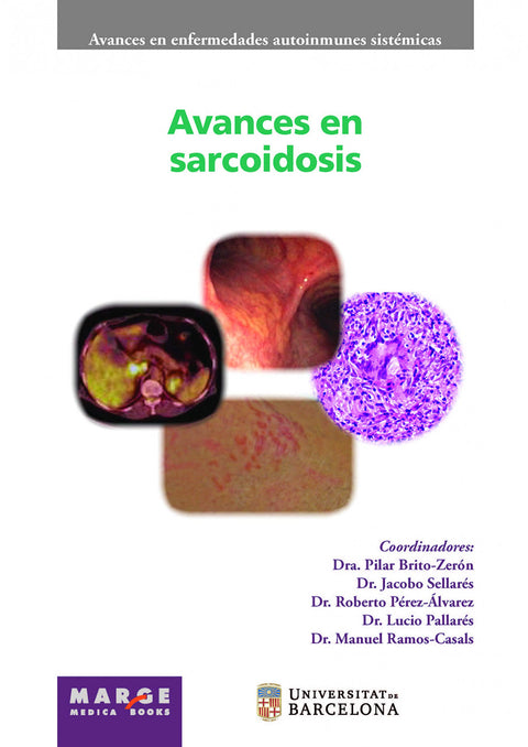  Avances en sarcoidosis 